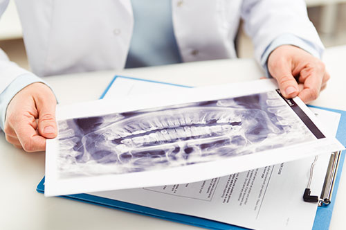 Why September Is the Right Time for Your Dental Checkup
